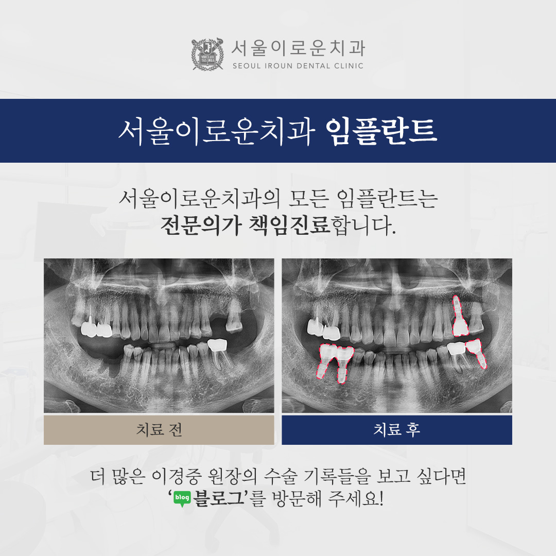 서울이로운치과의원 부천 대표 이미지