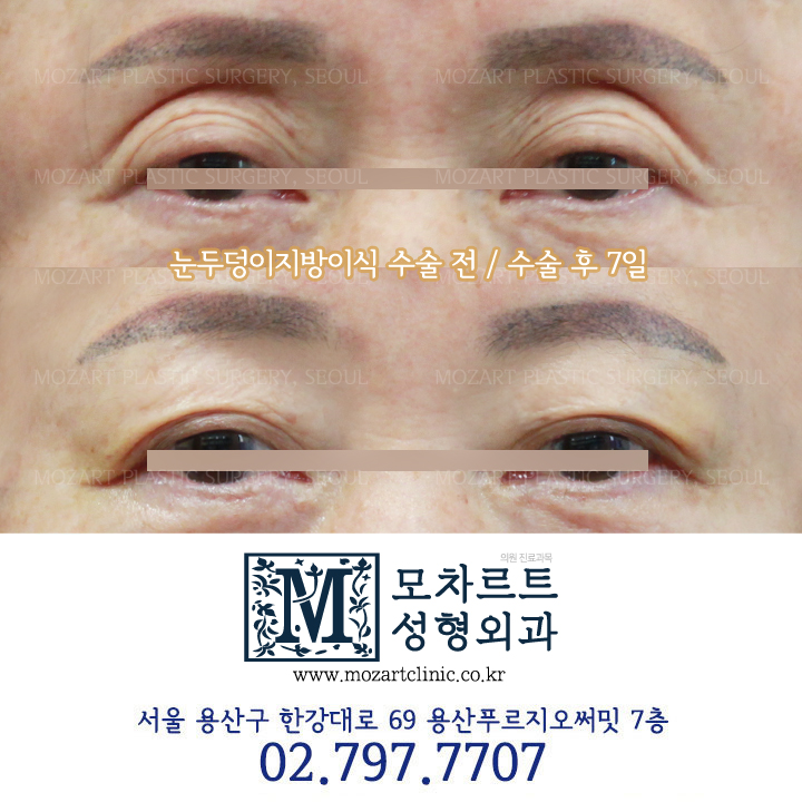 모차르트성형외과의원 대표 이미지