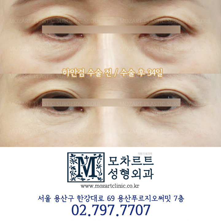 모차르트성형외과 대표 이미지