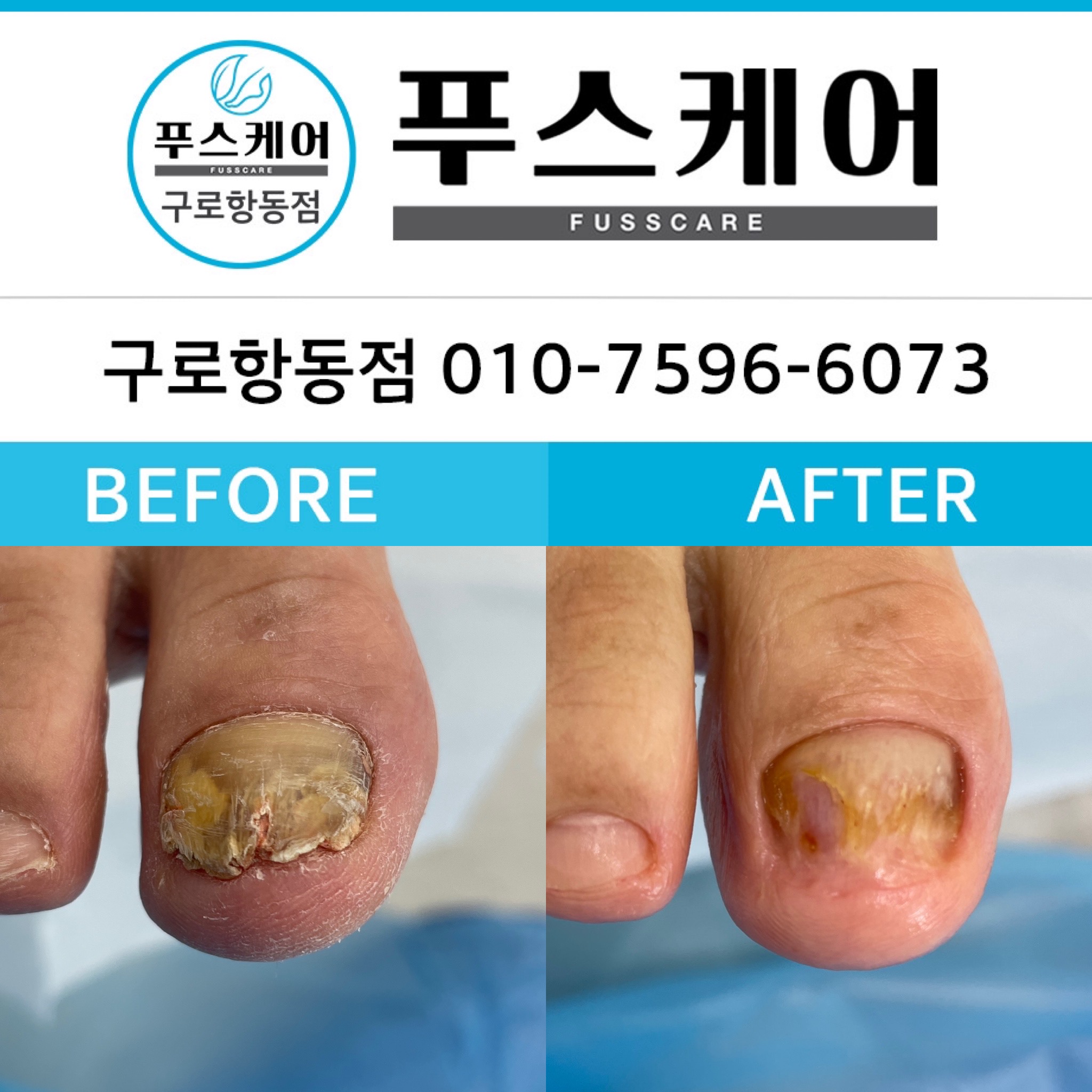 푸스케어 구로항동점 대표 이미지