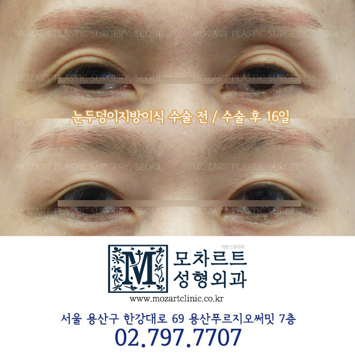 모차르트성형외과의원 대표 이미지