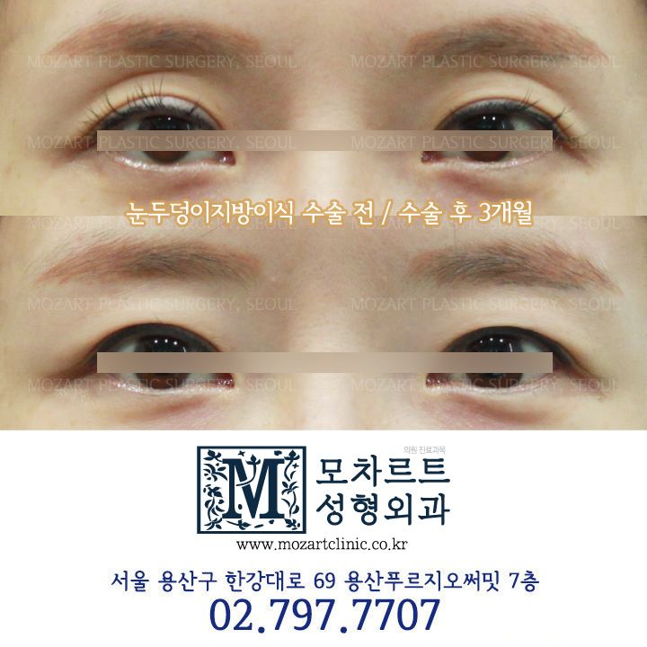 모차르트성형외과의원 대표 이미지