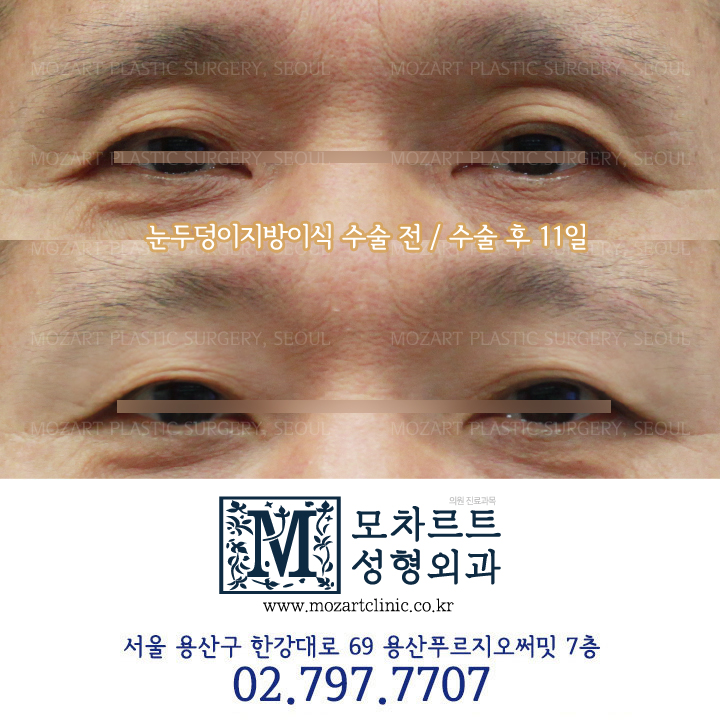 모차르트성형외과의원 대표 이미지