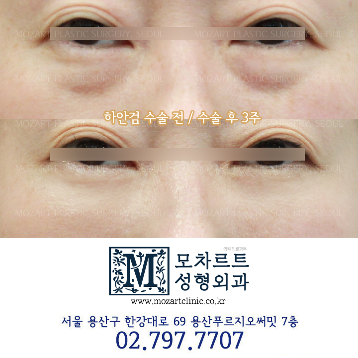 모차르트성형외과의원 대표 이미지