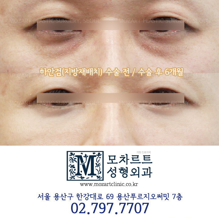 모차르트성형외과 대표 이미지