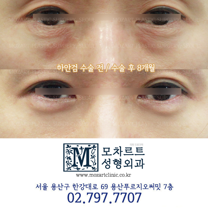 모차르트성형외과의원 대표 이미지