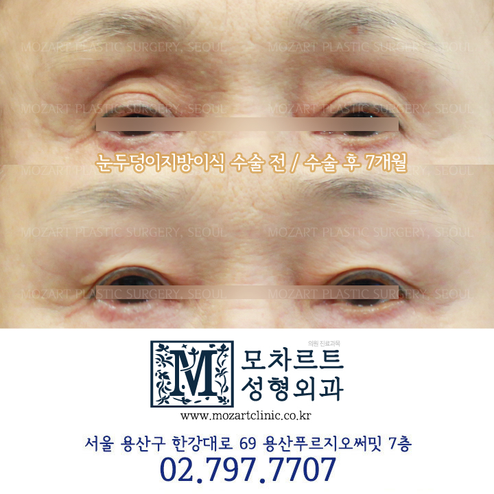 모차르트성형외과의원 대표 이미지