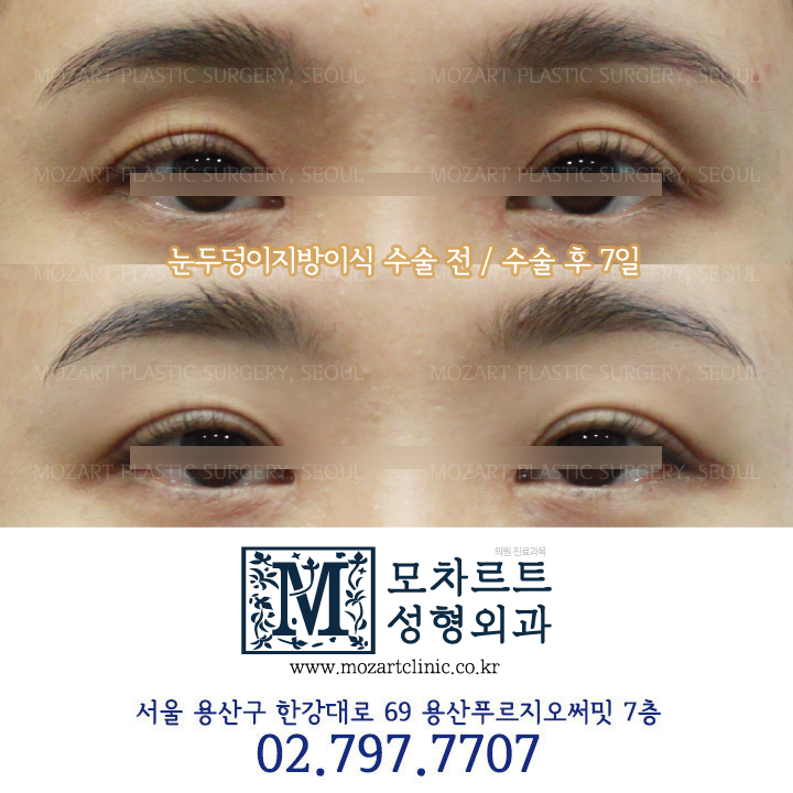 모차르트성형외과의원 대표 이미지