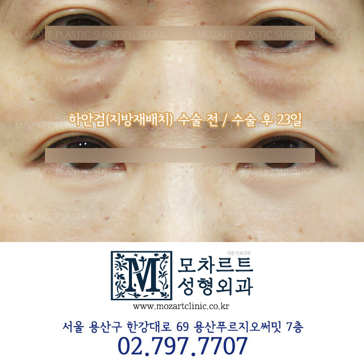 모차르트성형외과의원 대표 이미지