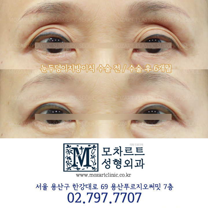 모차르트성형외과의원 대표 이미지