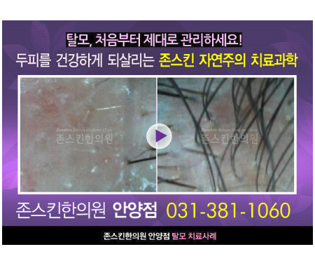 존스킨한의원 안양 대표 이미지