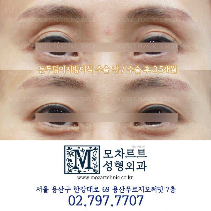 모차르트성형외과의원 대표 이미지