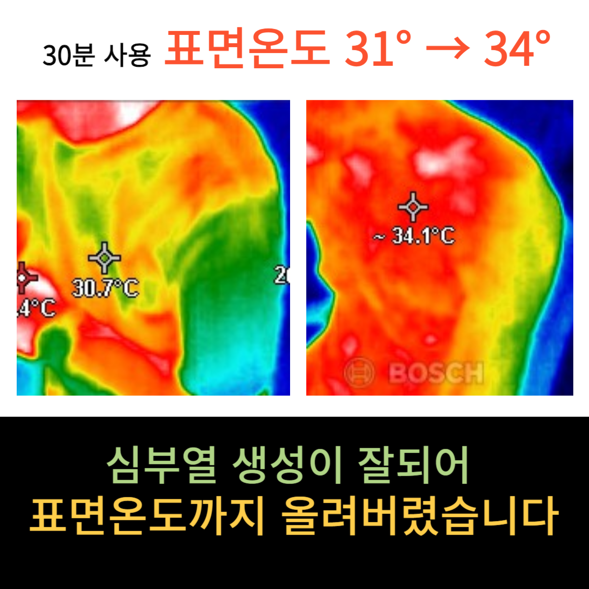 미가의료기 미카페