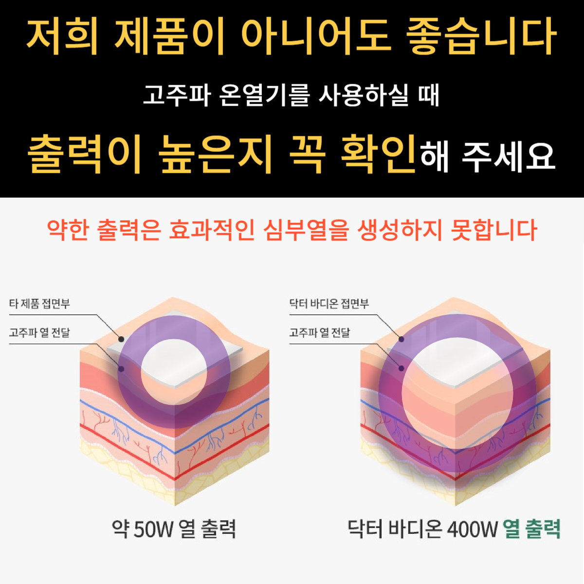 미가의료기 미카페