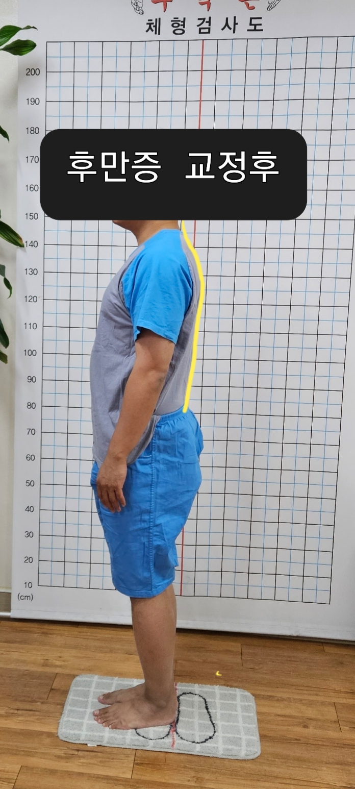 주약손체형교정명가