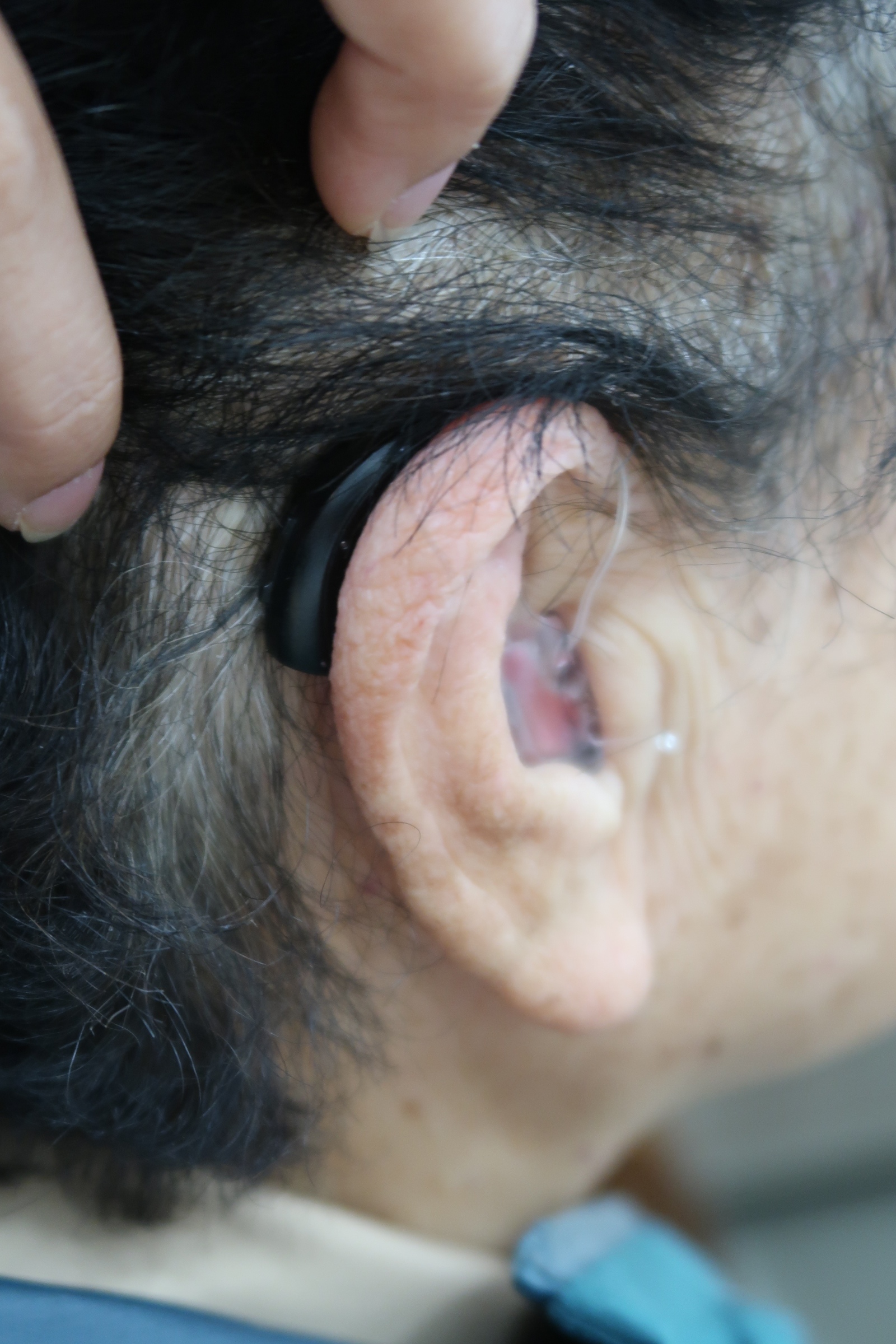 스타키보청기 동작센터