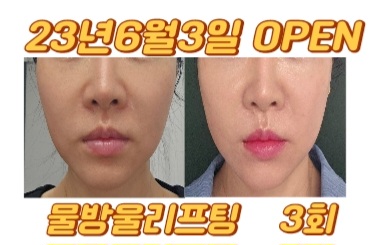 J에스테틱