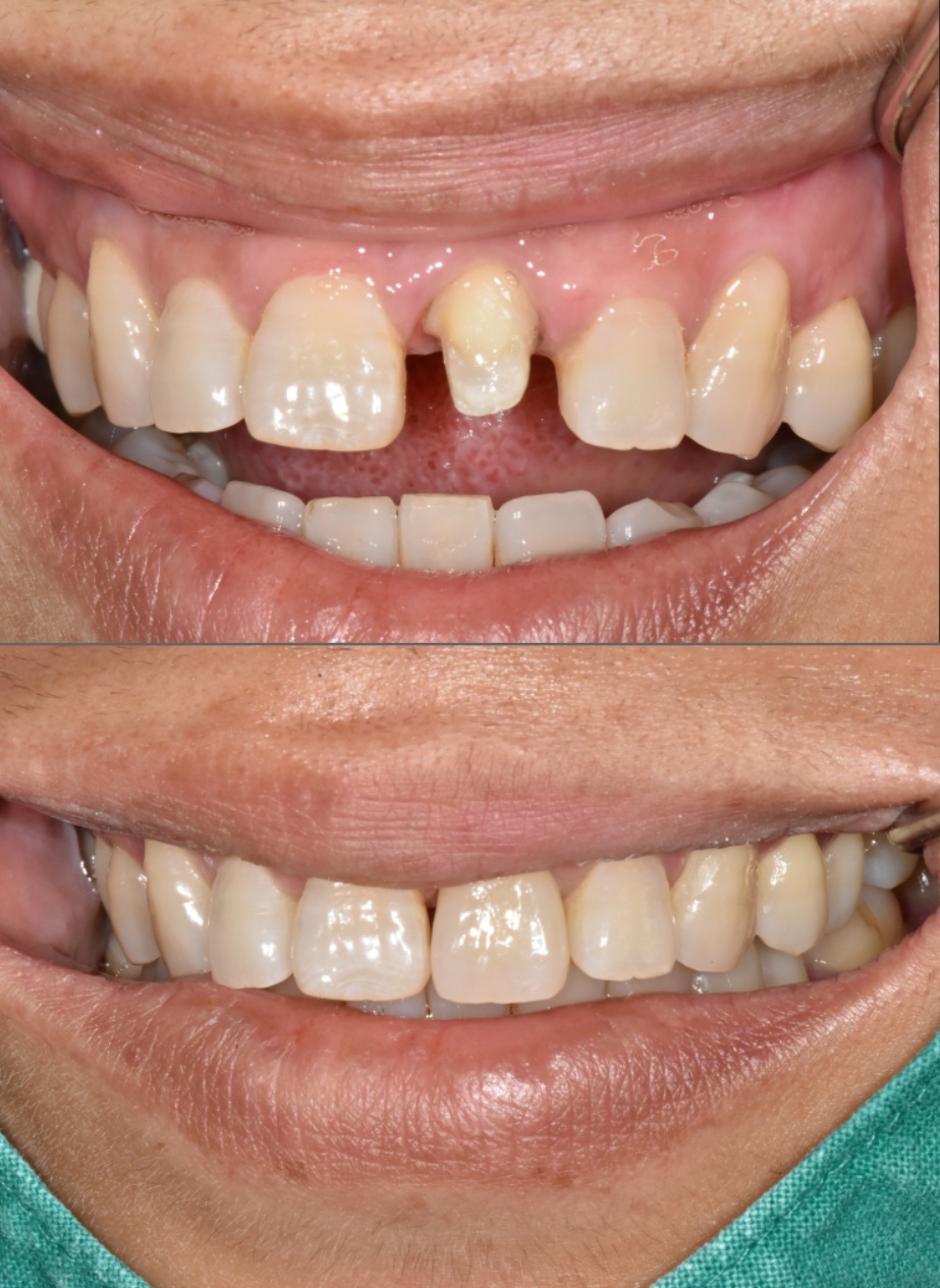 미소고운치과의원 대표 이미지