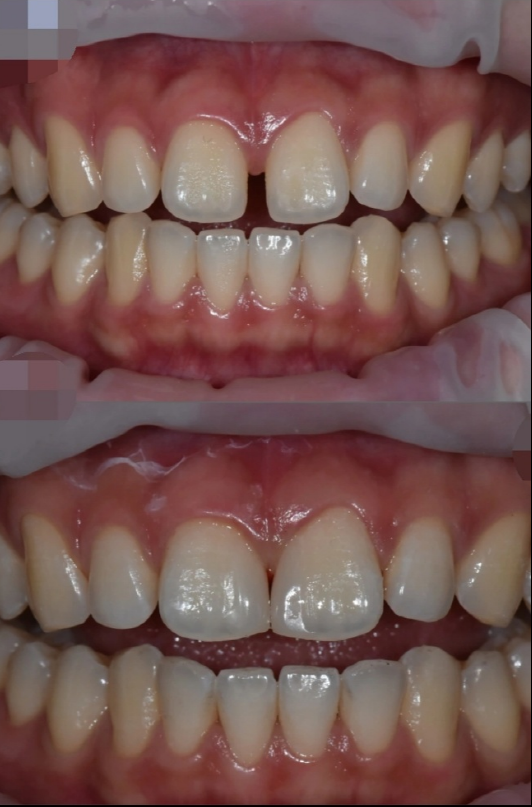 미소고운치과의원 대표 이미지