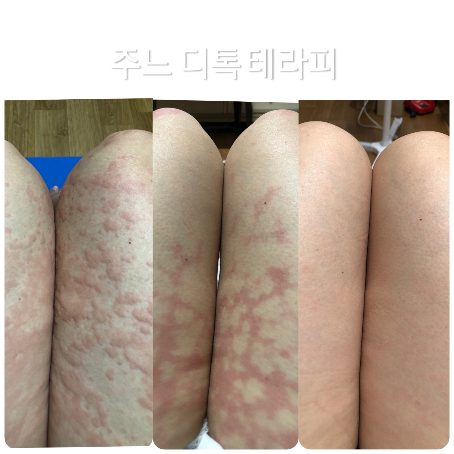 스킨살롱 주느
