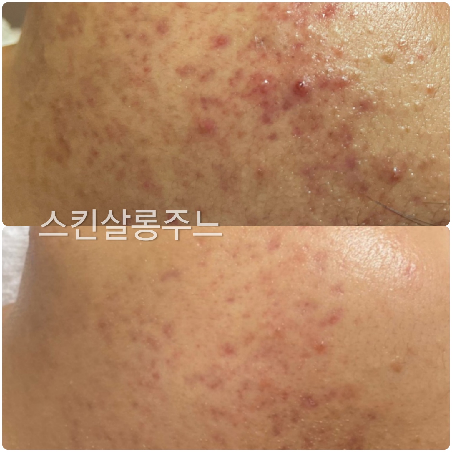 스킨살롱 주느