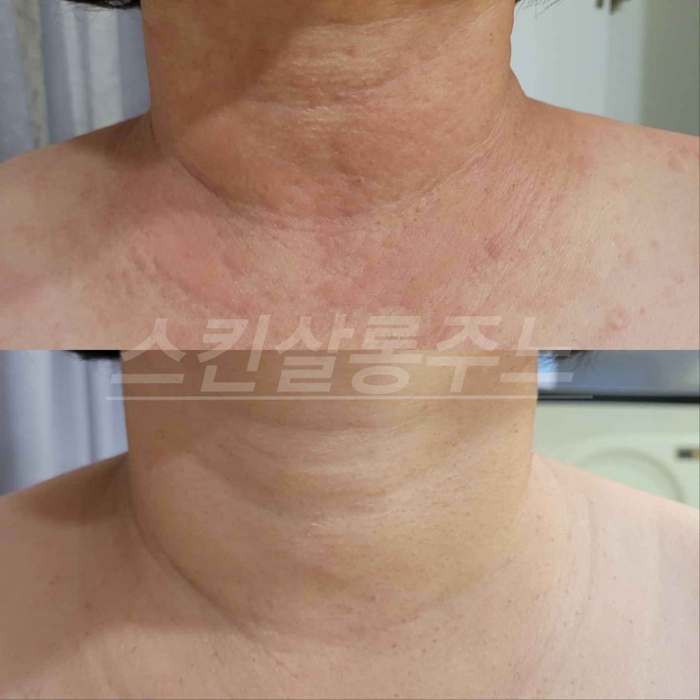 스킨살롱 주느