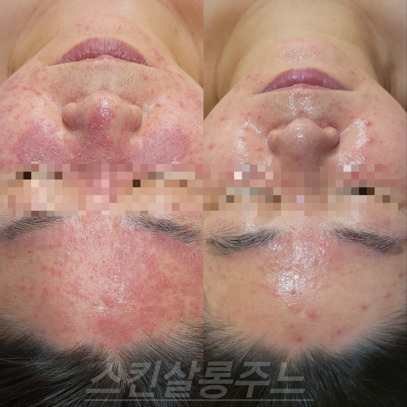 스킨살롱 주느