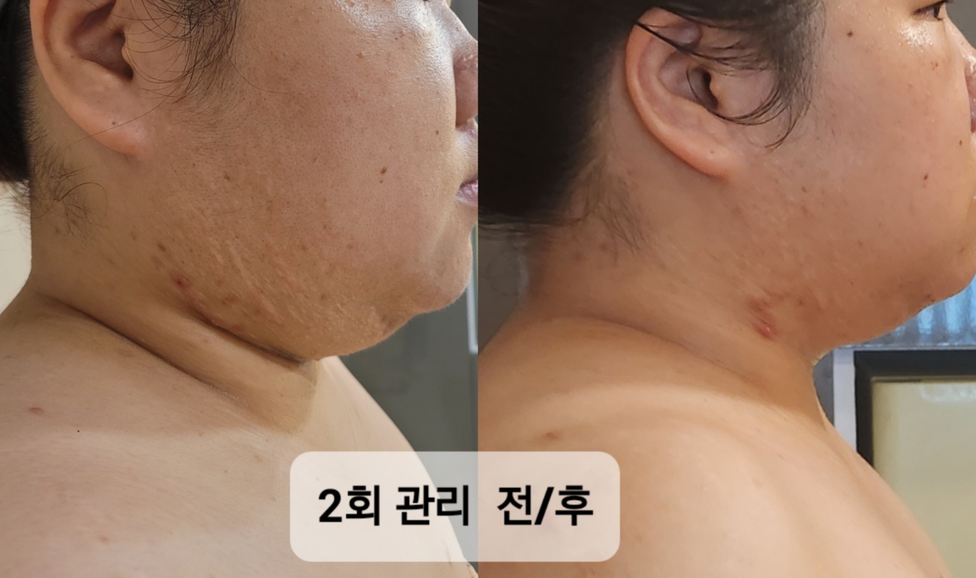 스킨살롱 주느