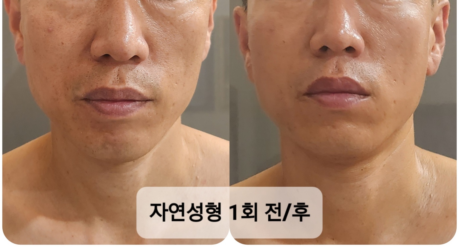 스킨살롱 주느