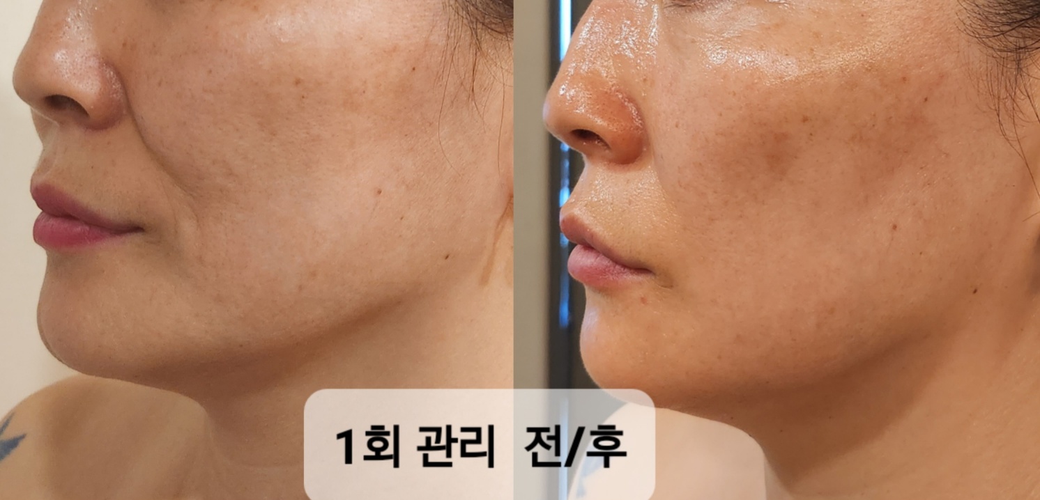 스킨살롱 주느