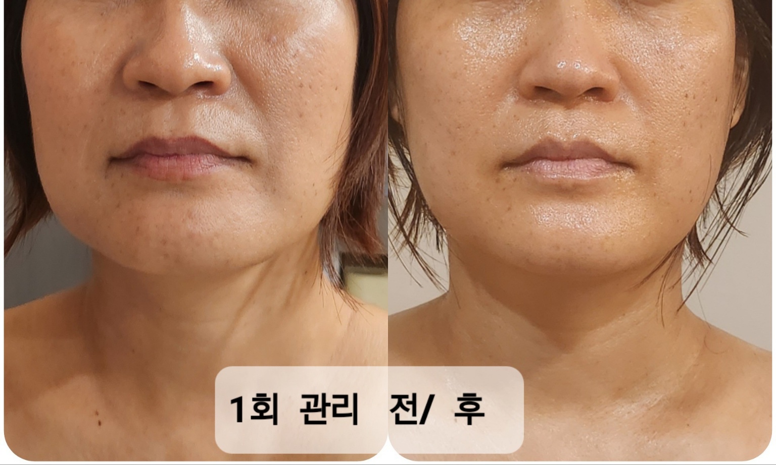 스킨살롱 주느
