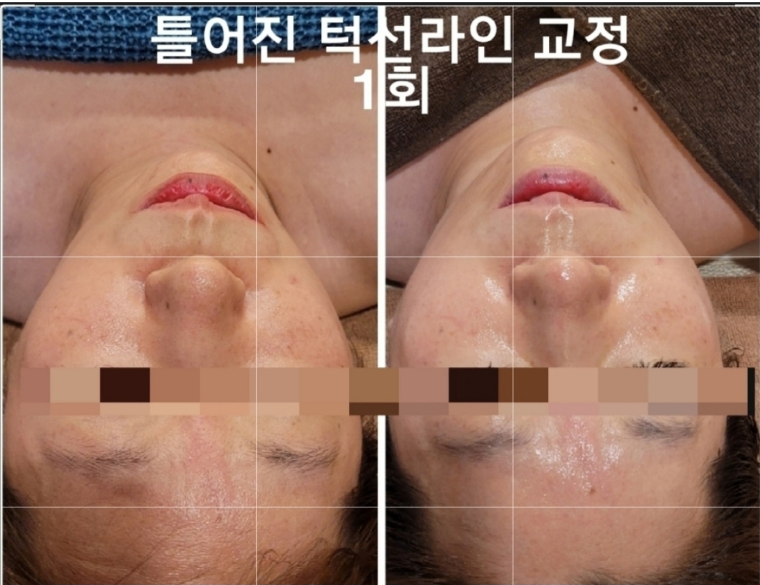 스킨살롱 주느
