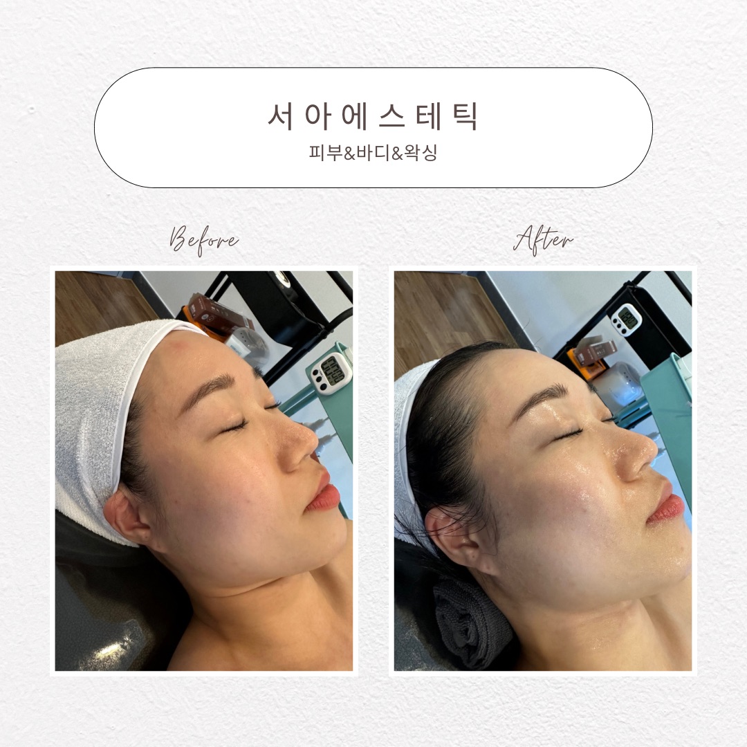 서아에스테틱 창원사림점