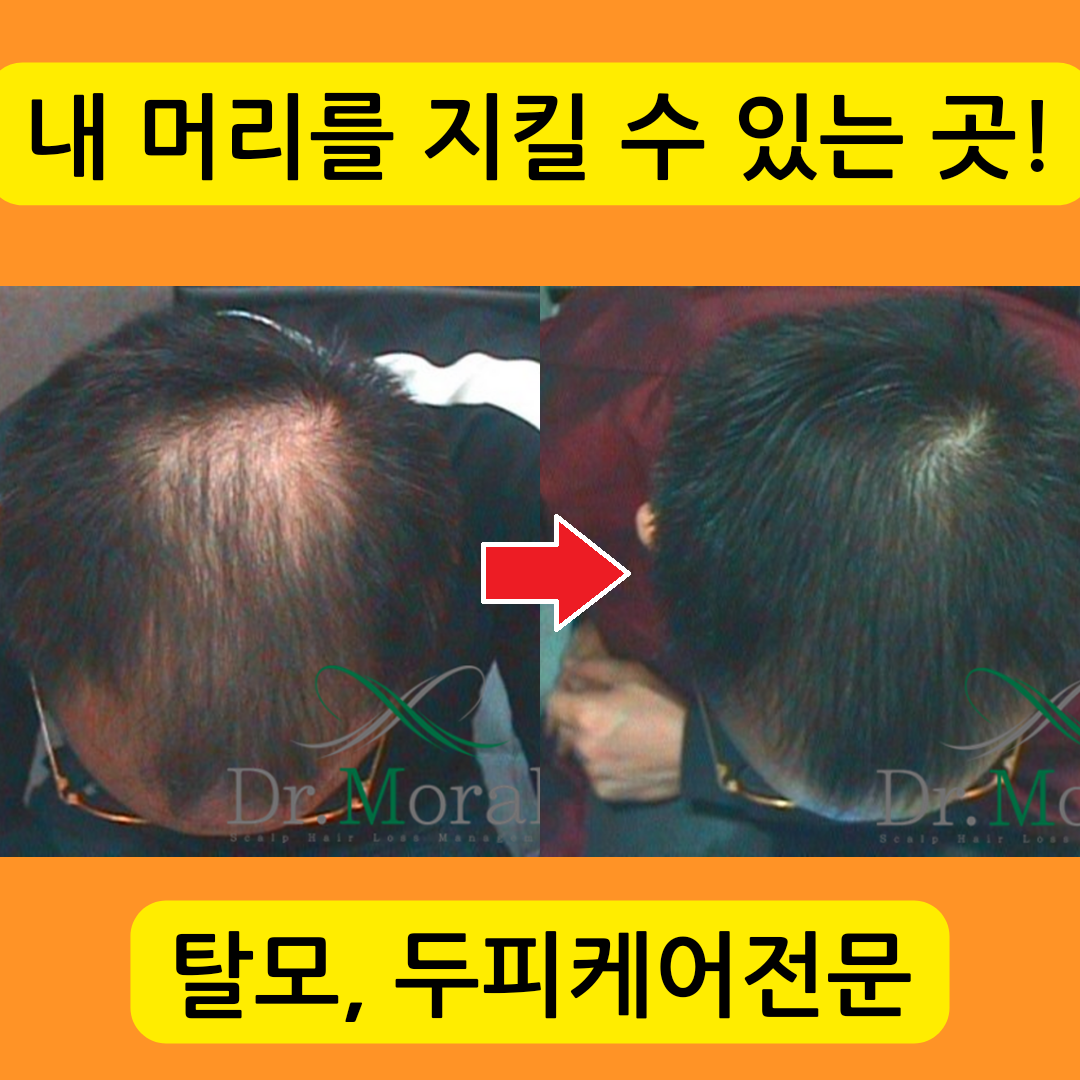 닥터모락 종로점 대표 이미지