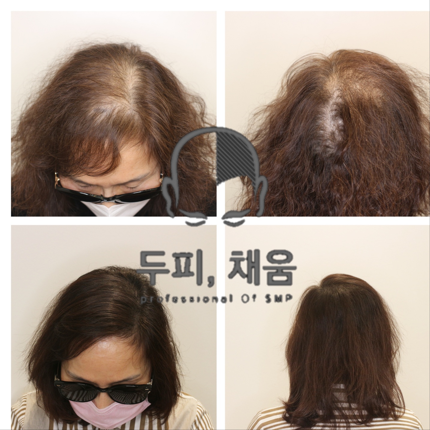 이송연두피연구소 대표 이미지