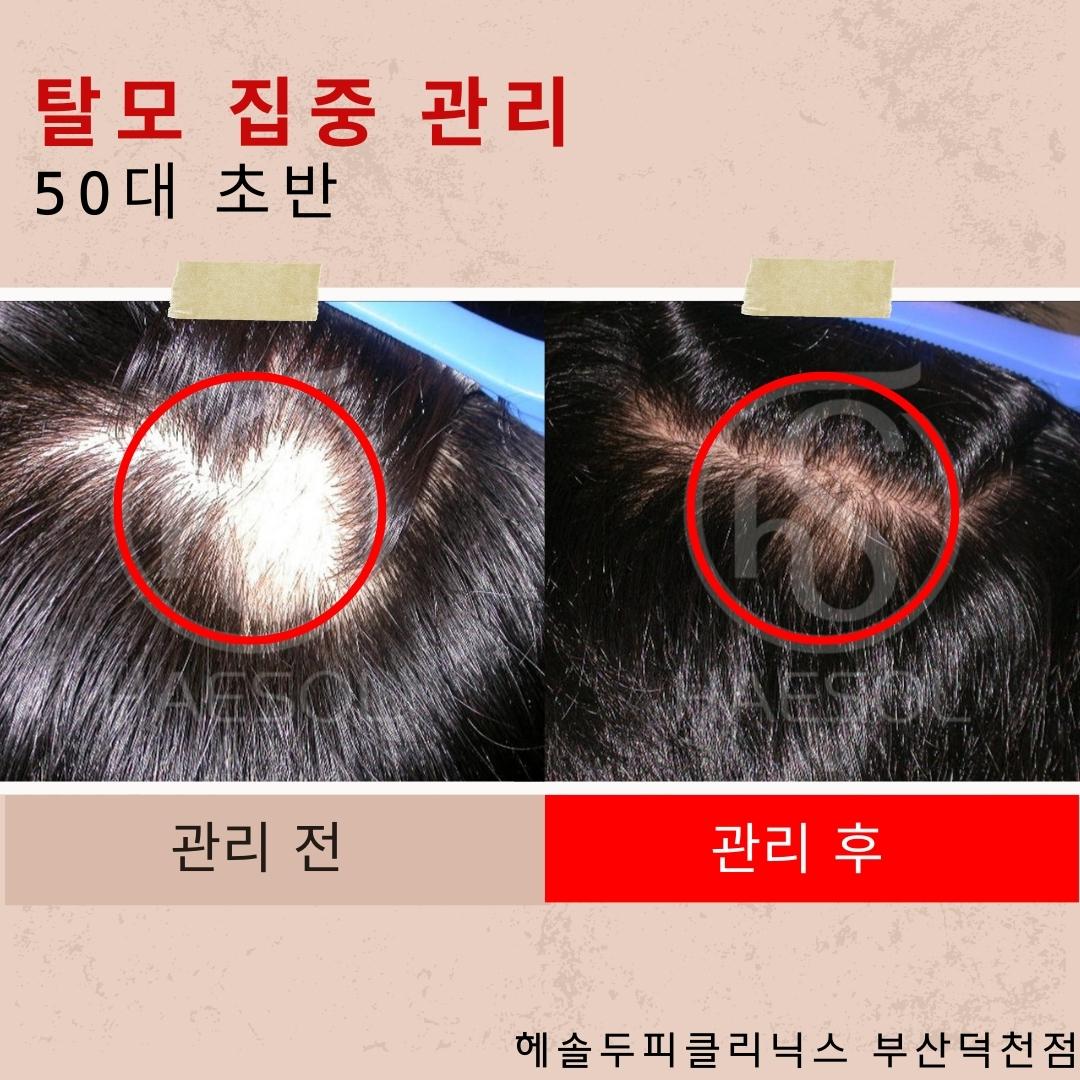 헤솔두피클리닉스 부산덕천점