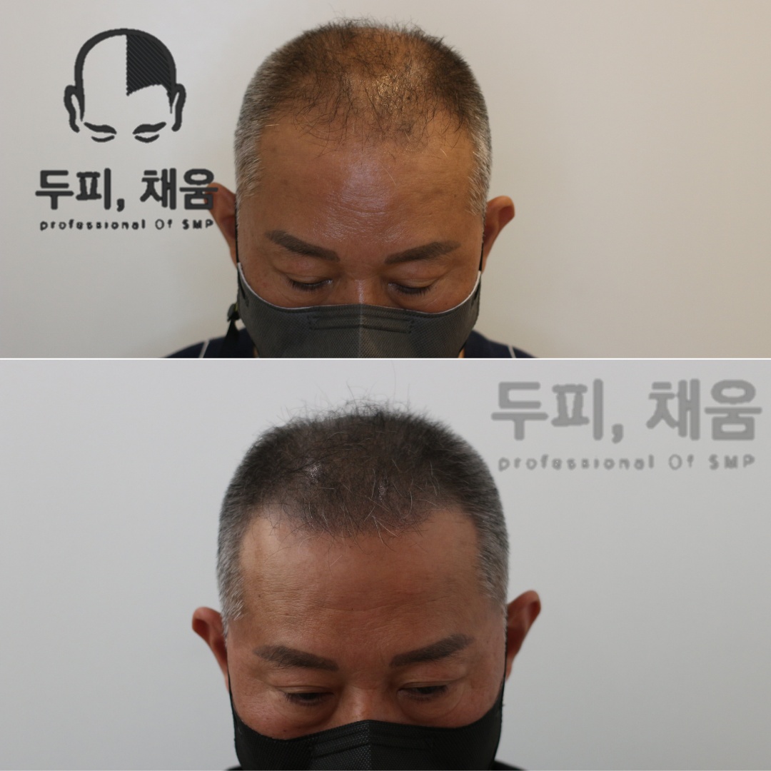 이송연두피연구소 대표 이미지