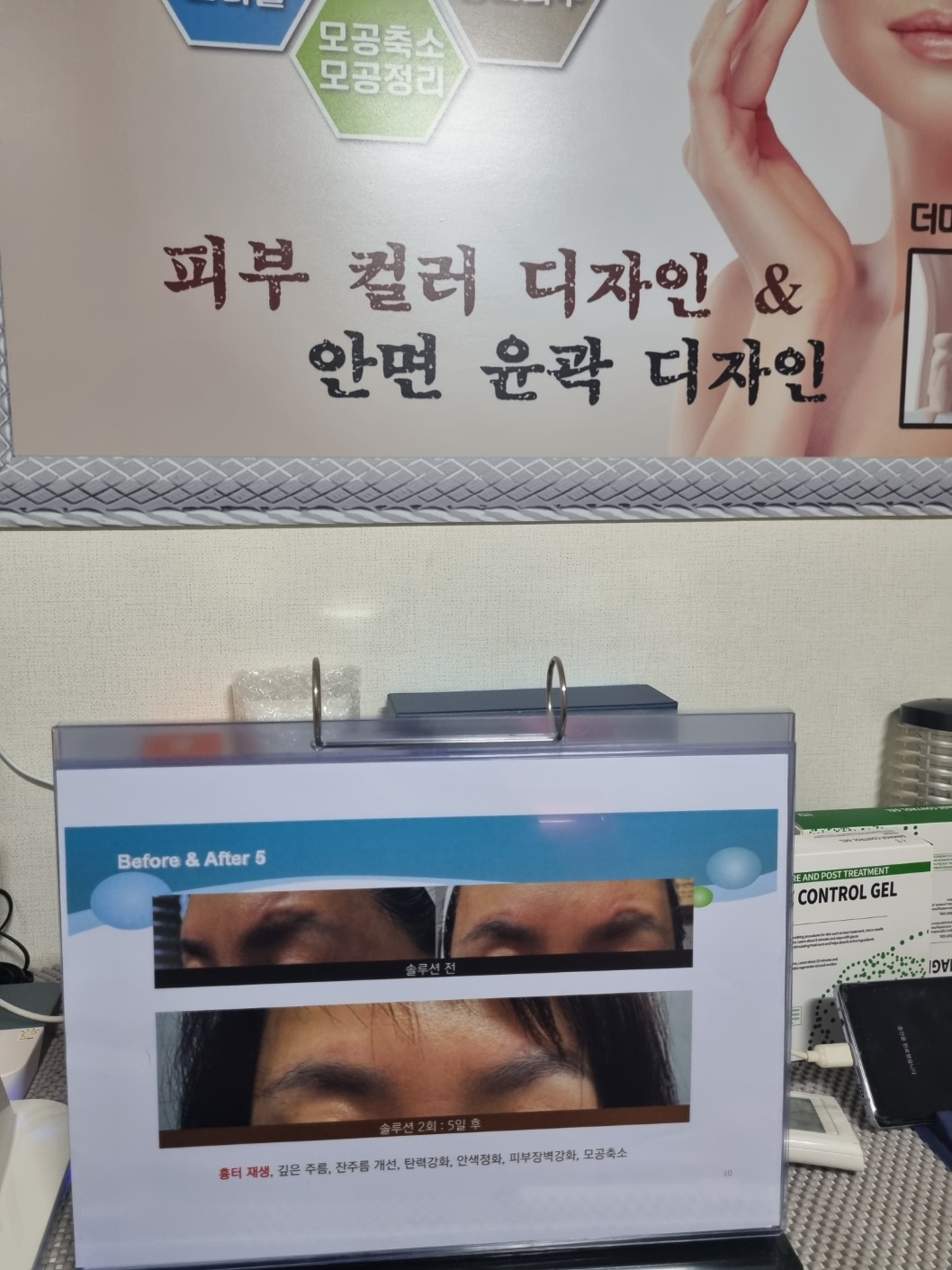 치유명가 힐링하우스 마사지
