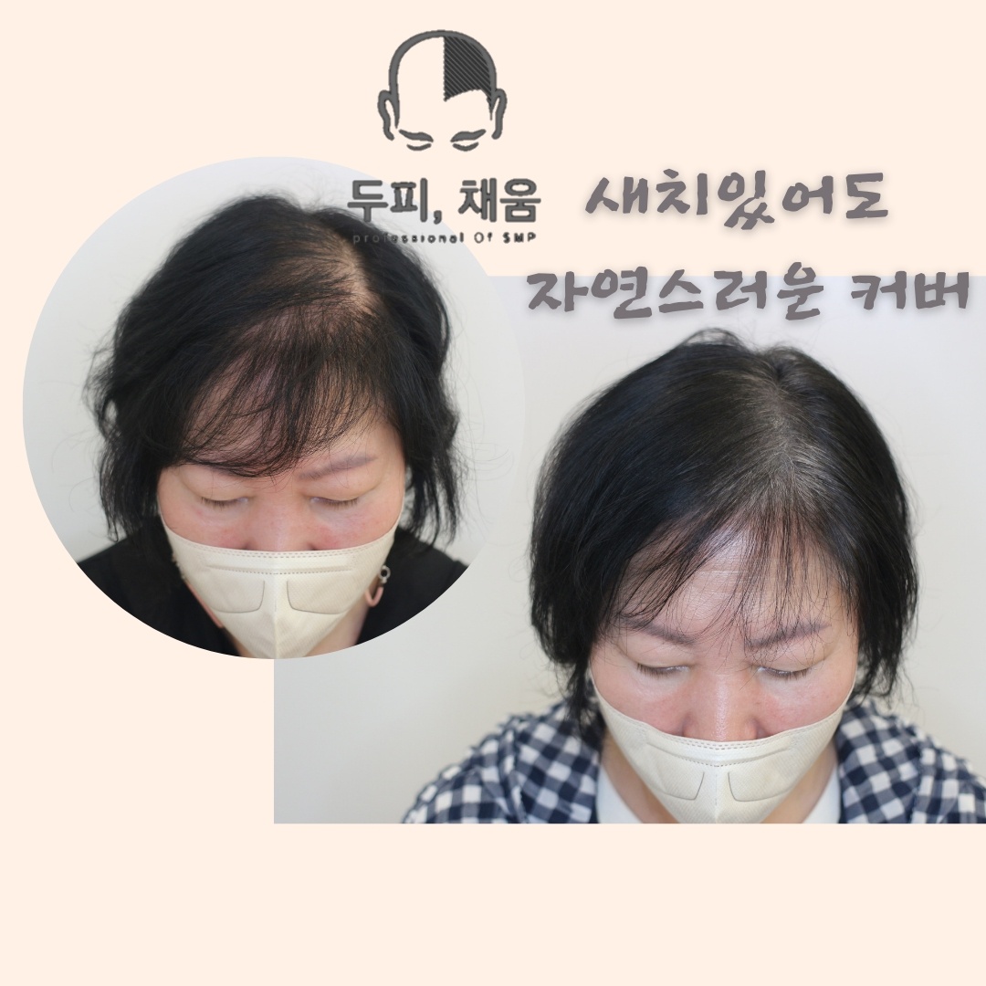 이송연두피연구소 대표 이미지
