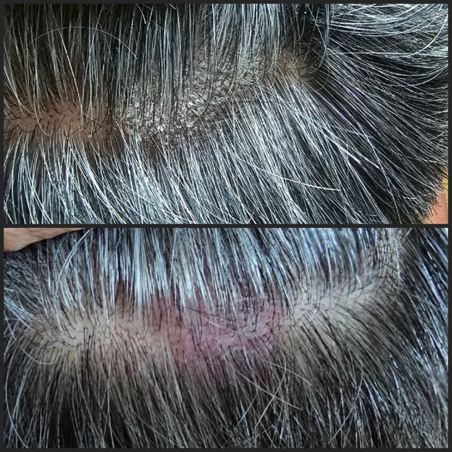 칼리아 대표 이미지