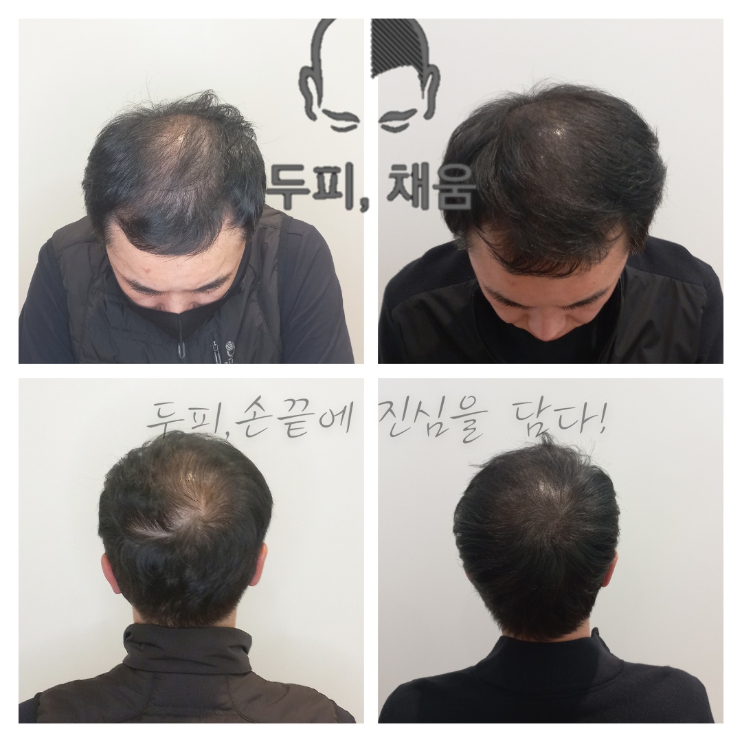 이송연두피연구소 대표 이미지