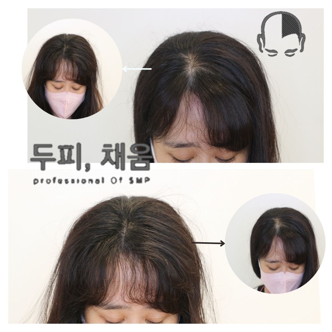 이송연두피연구소 대표 이미지