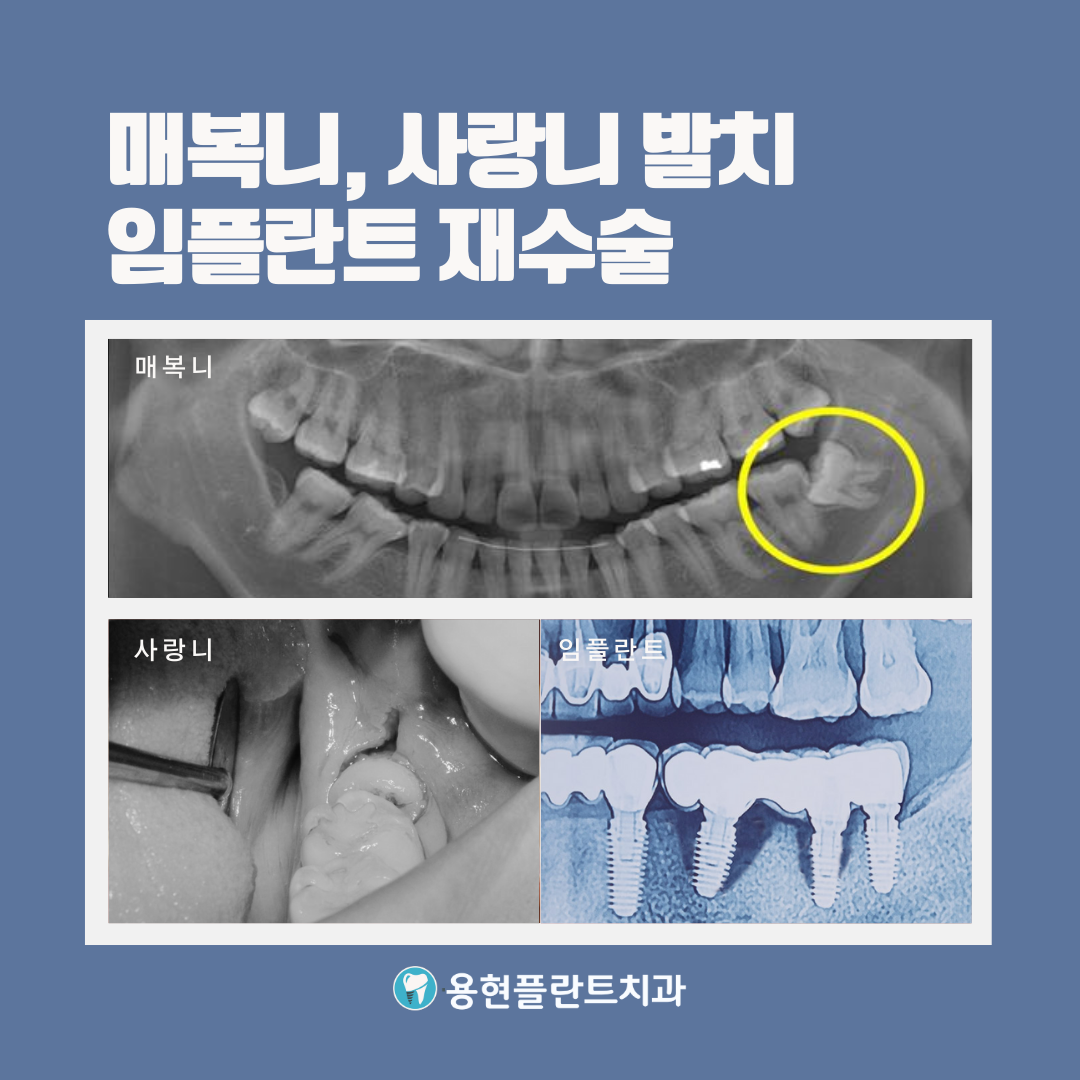 플란트구강악안면외과치과의원 대표 이미지