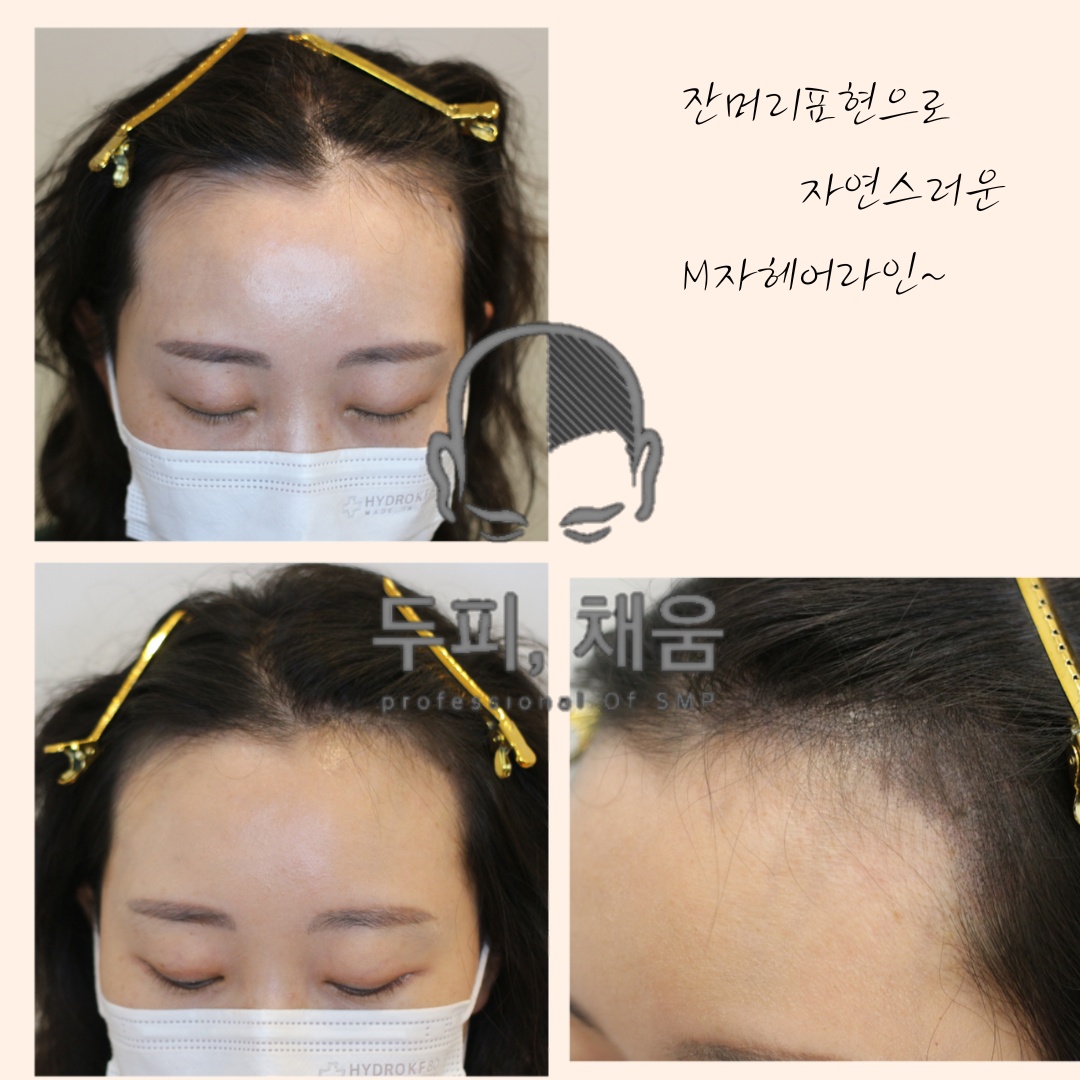 이송연두피연구소 대표 사진