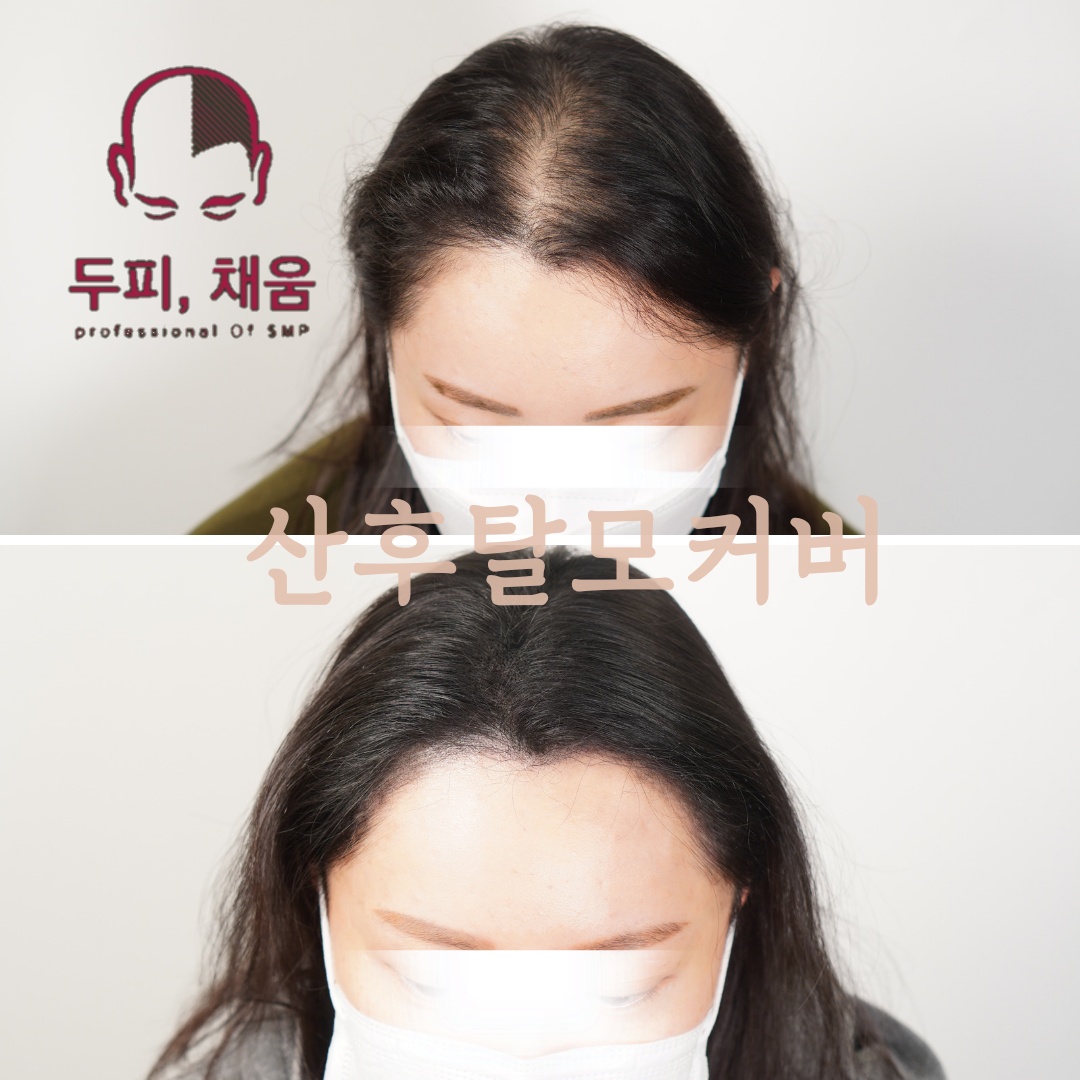 이송연두피연구소 대표 이미지