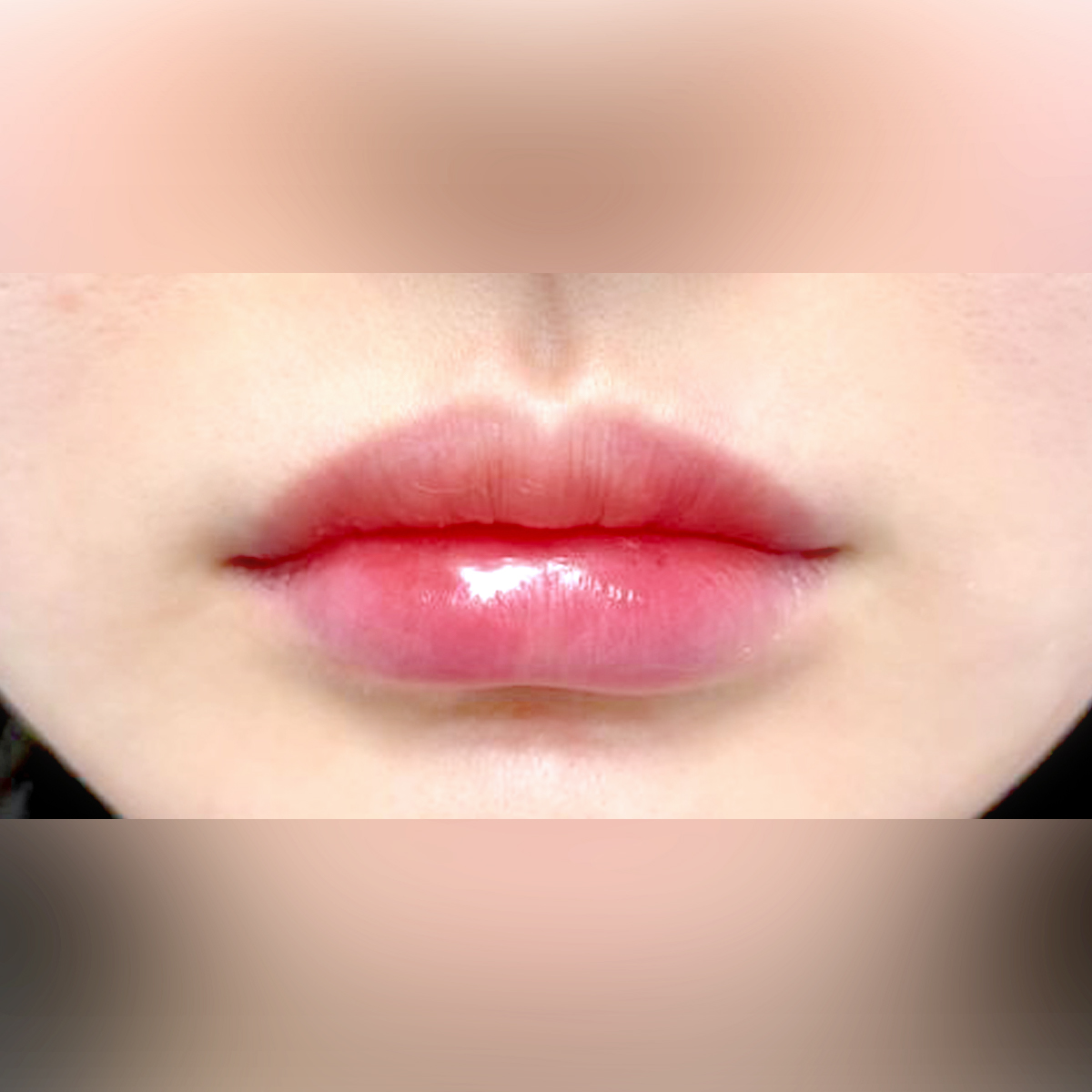 엘뷰티의원