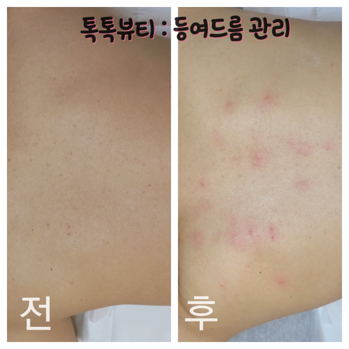 톡톡뷰티 톡톡뷰티센터