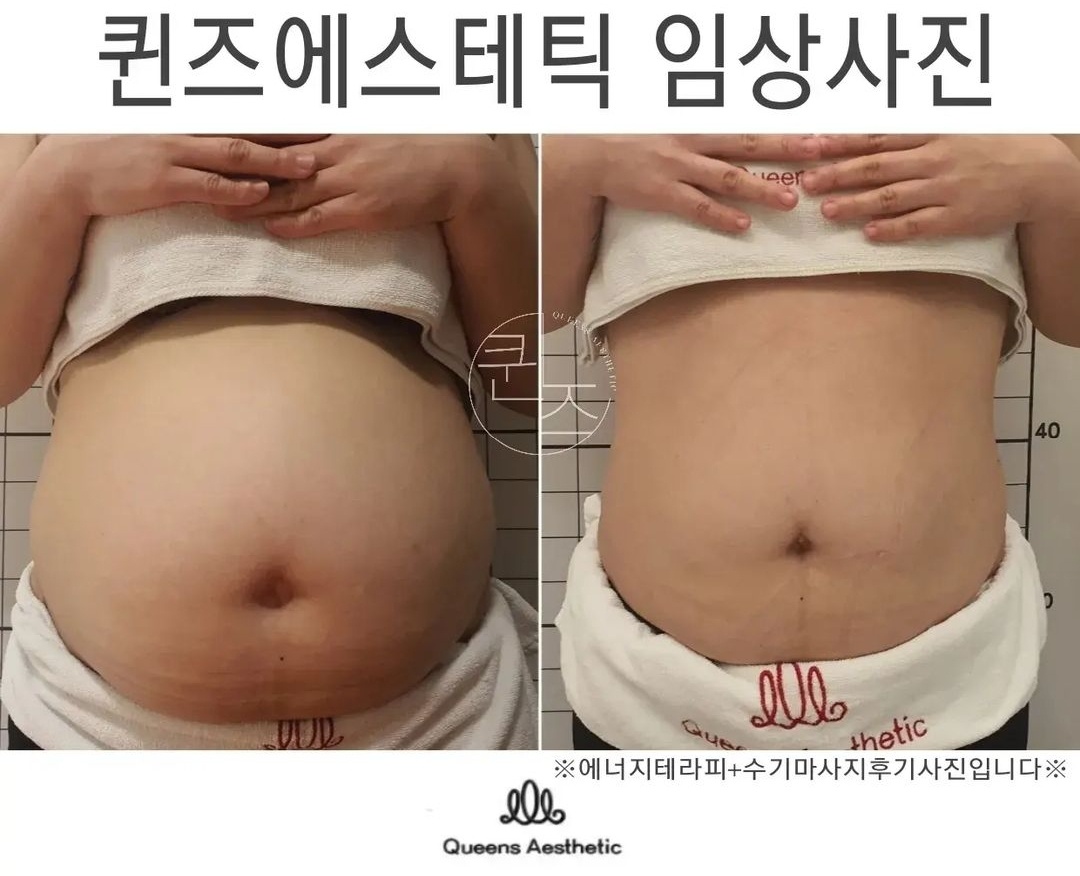 퀸즈산모케어 photo 6
