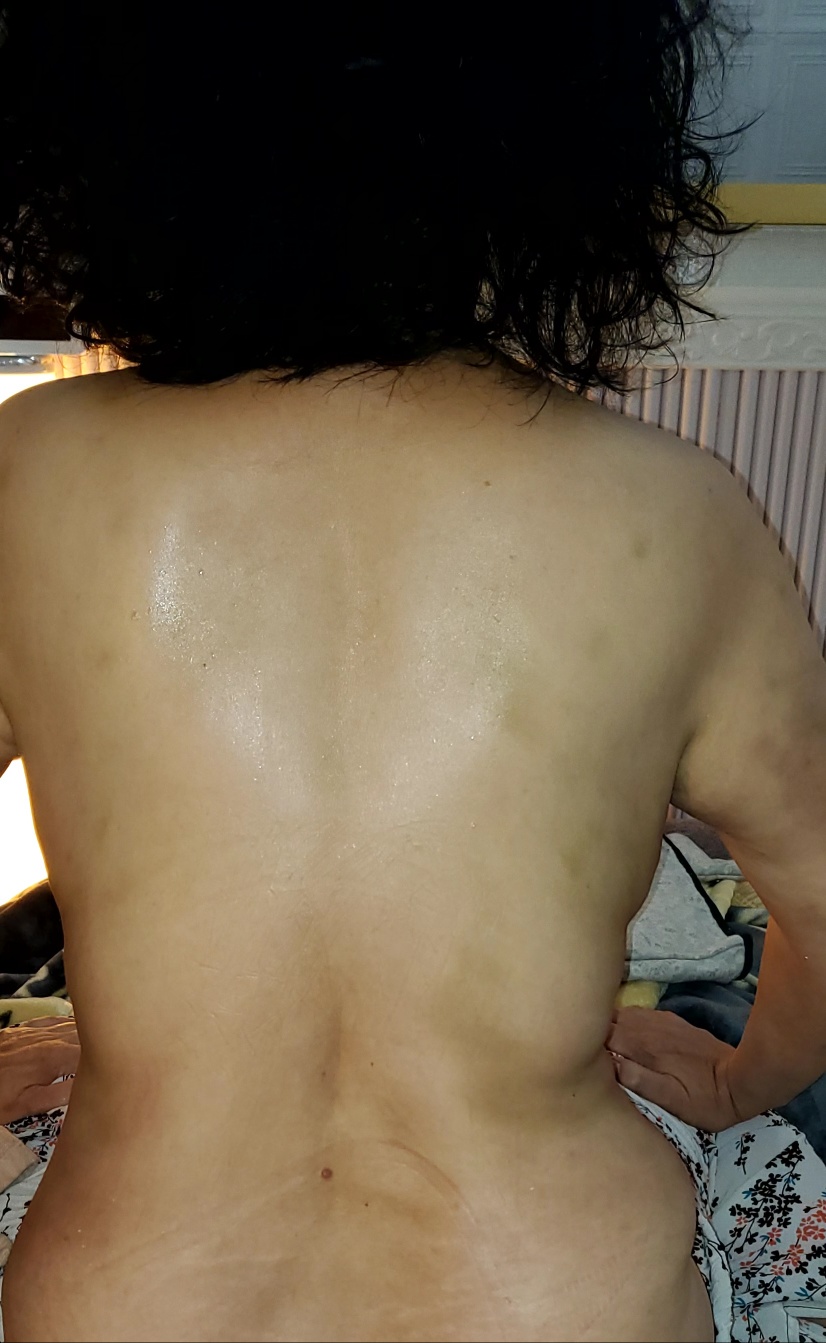 숨스킨케어 피부관리&체형관리&리프팅&에스테틱&고주파 대표 이미지