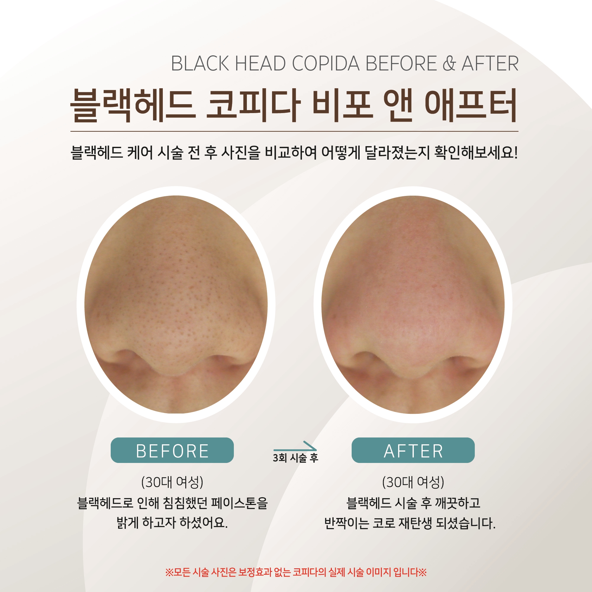 코피다 대표 이미지